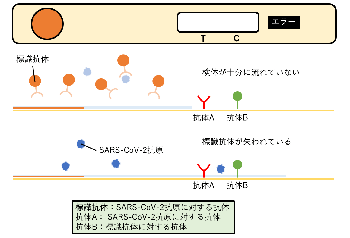 なぜトキソプラズマ症検査が必要なのでしょうか?
